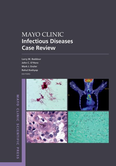 Mayo Clinic Infectious Diseases Case Review